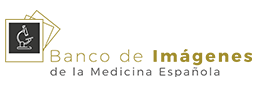 Banco de Imágenes de la Medicina Española